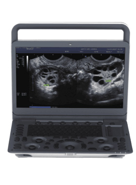 SonoScape E1 Ultrasound