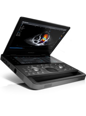 SonoScape E11 Ultrasound