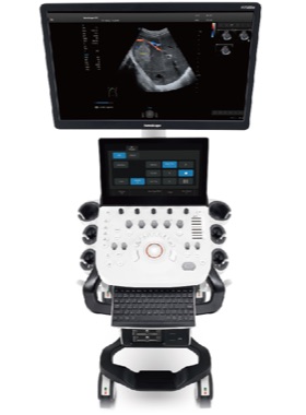 SonoScape P25 Elite Ultrasound
