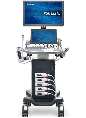 SonoScape P50 Elite Ultrasound