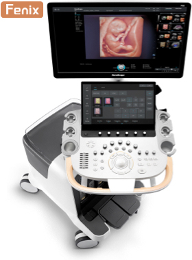 SonoScape P80 Ultrasound