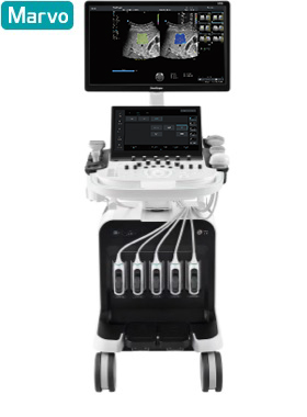 SonoScape S70i Ultrasound