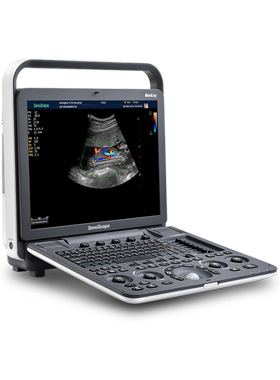 SonoScape S8 Exp Ultrasound