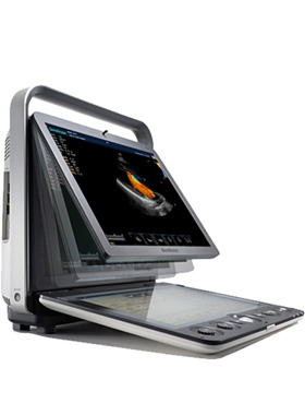 SonoScape S9 Ultrasound